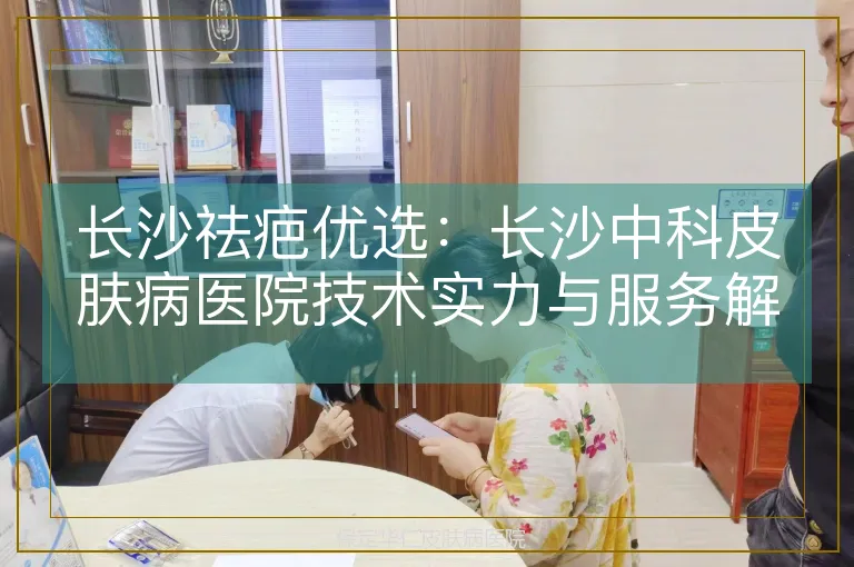 长沙祛疤优选：长沙中科皮肤病医院技术实力与服务解析