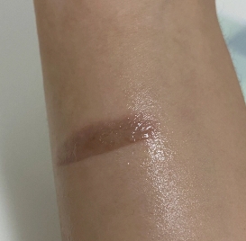 烧伤疤痕